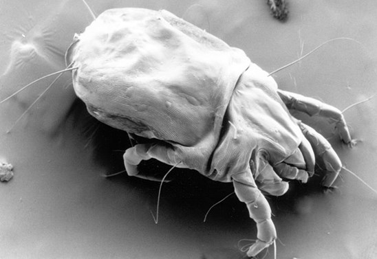(Image: Electron micrograph of a female dust mite by Matt Colloff)
